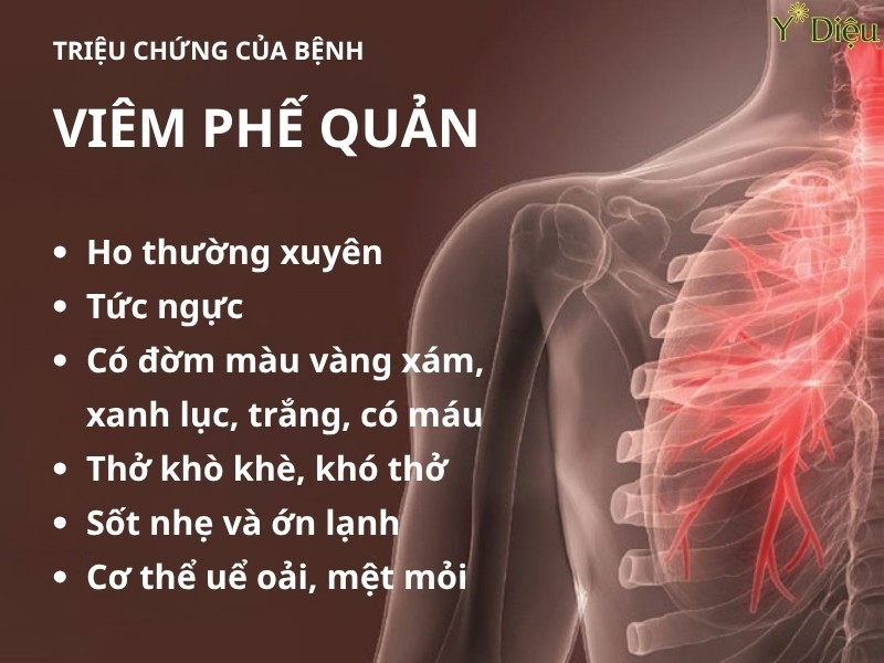 Khi bị viêm phế quản mạn tính thì sẽ có nhiều triệu chứng như ho, khó thở, mệt mỏi